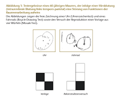 neuropsychologische testung