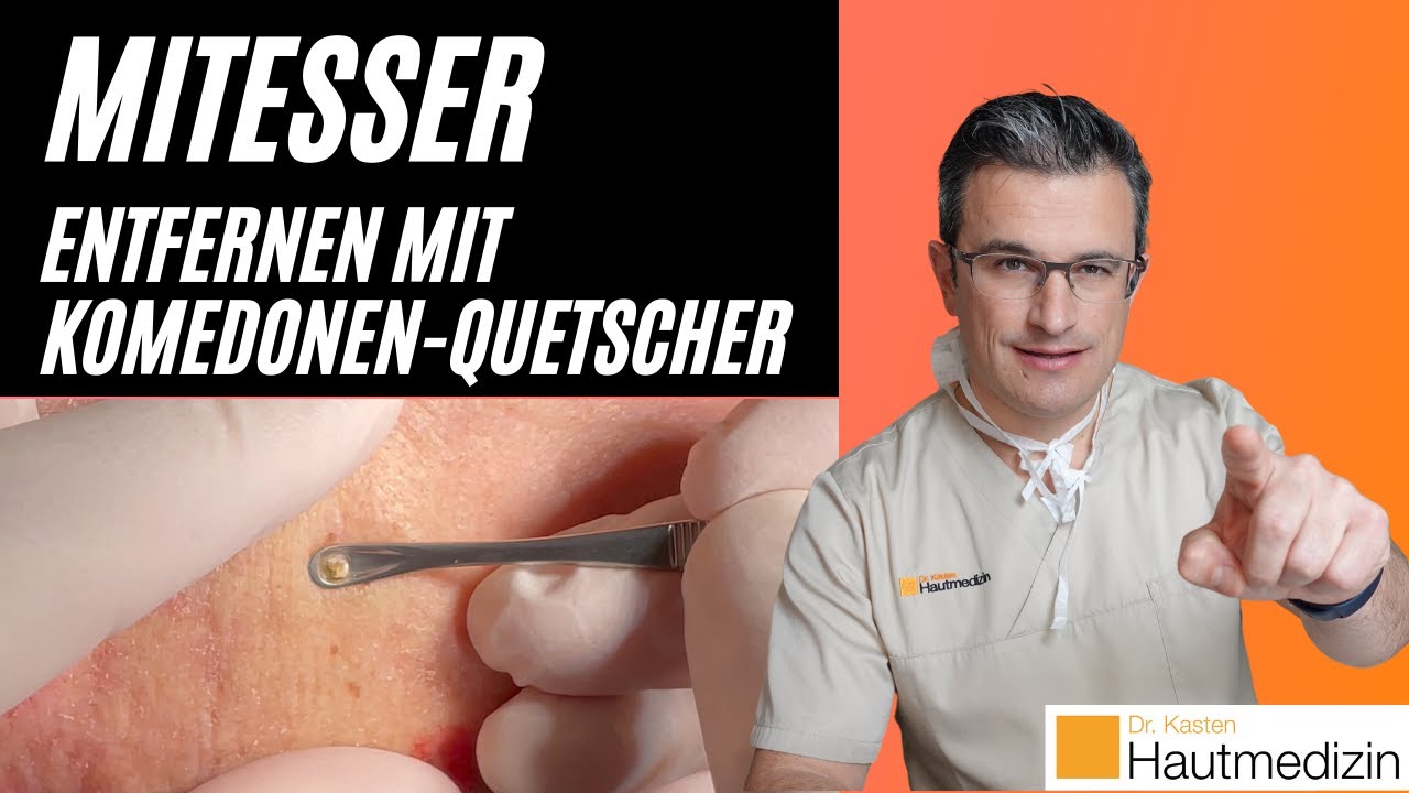 mitesser und pickel entfernen
