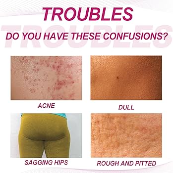 pickel am po loswerden