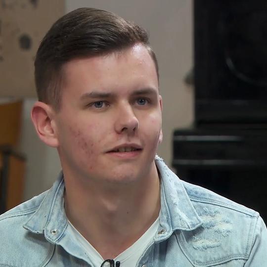 aknenarben loswerden