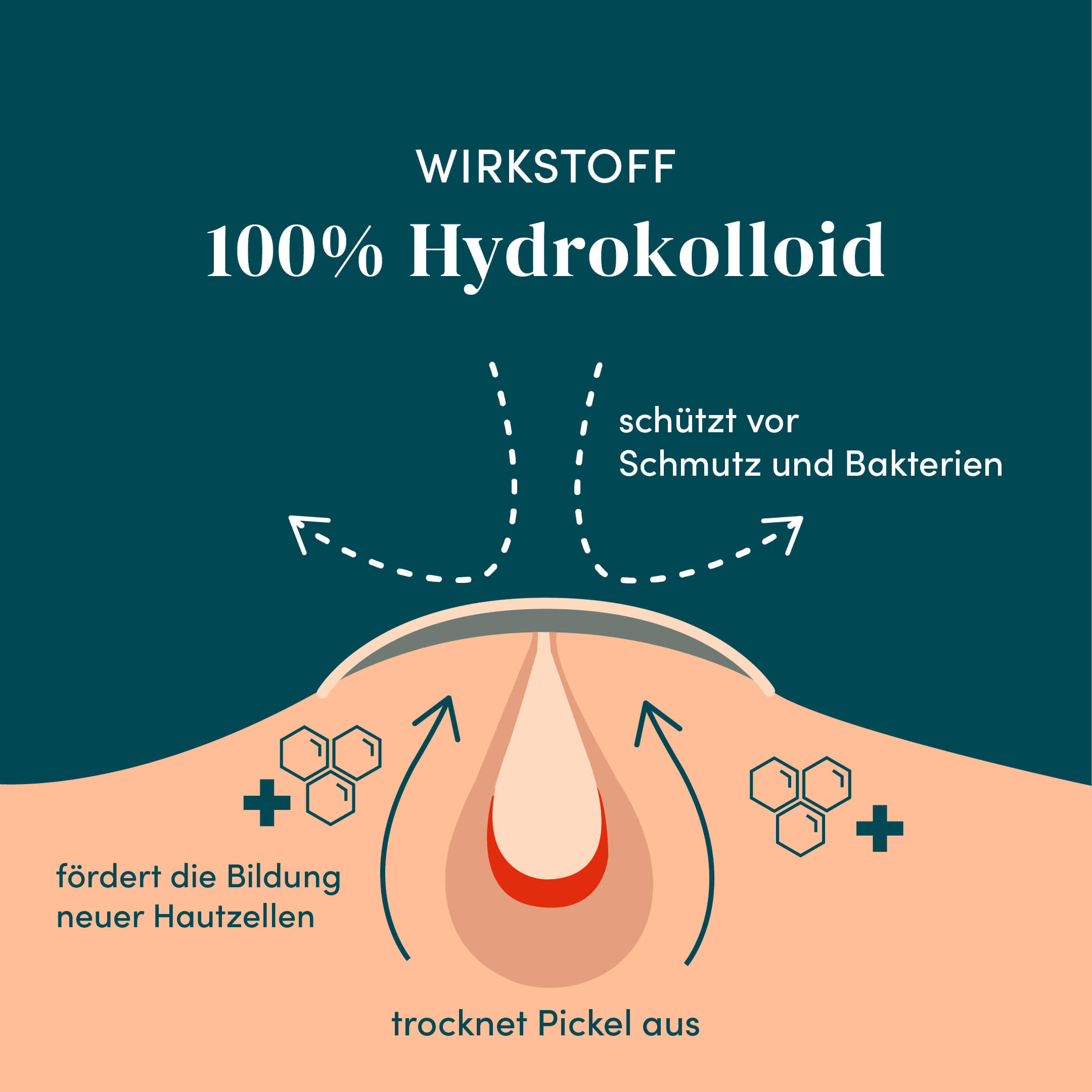 pickel loswerden über nacht